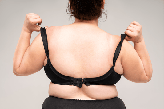 Is Bra Strap Syndrome a Real Concern?