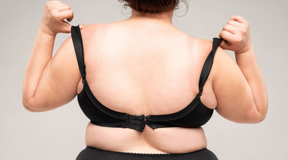 Close-up of woman’s back with bra strap marks.